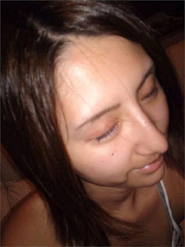 Chạy theo mốt, người đẹp trả giá vì chiếc mũi dài ngoằng, quá đà