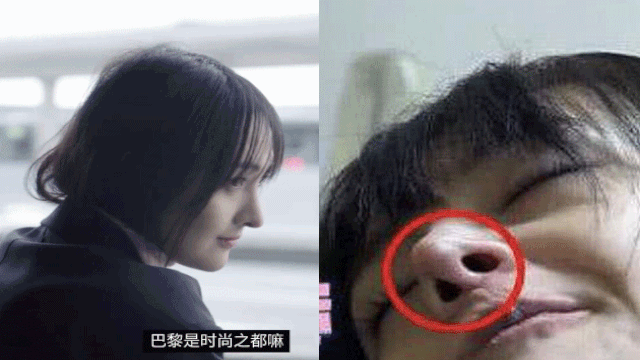 ất nhiều blogger đã phân tích mũi của Trịnh Sảng ở nhiều góc độ, cho thấy việc lạm dụng 