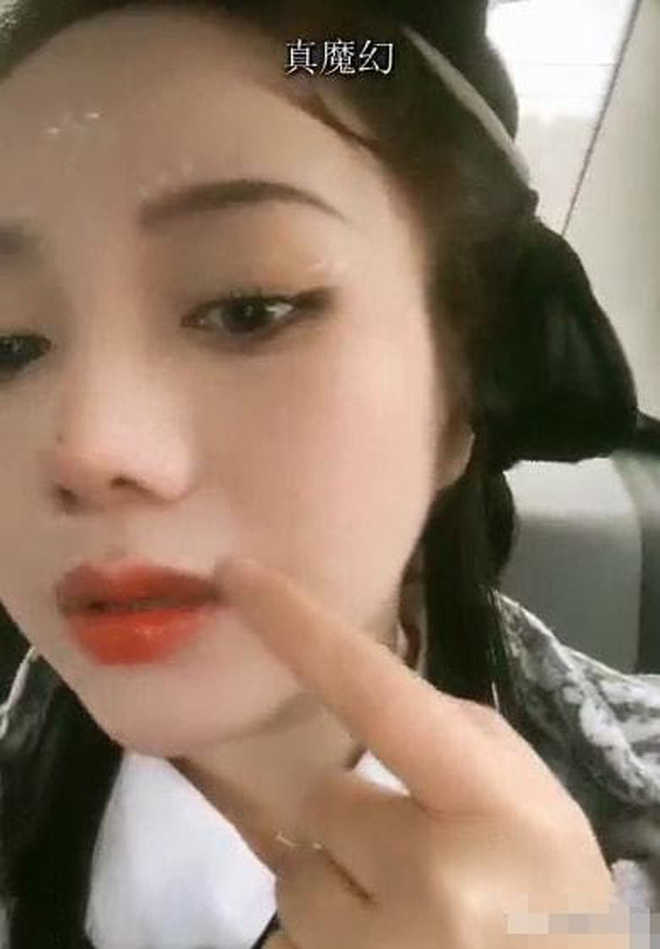 Nữ streamer chỉ ra di chứng hậu phẫu thuật của mình