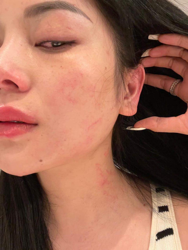 Ca sĩ bolero cho biết nguyên nhân cô bị đánh là vì ai đó cố tình bịa chuyện, hãm hại cô