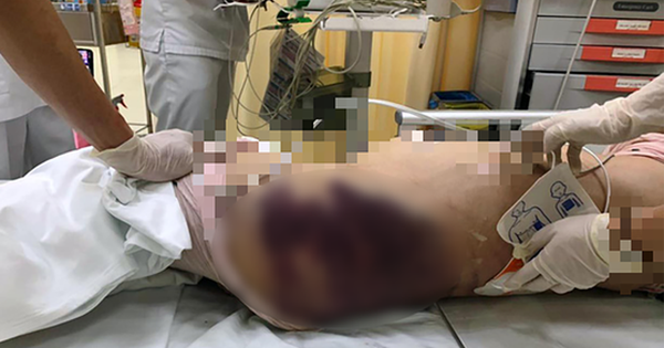 Trên người cháu bé có nhiều vết thương - ảnh ND