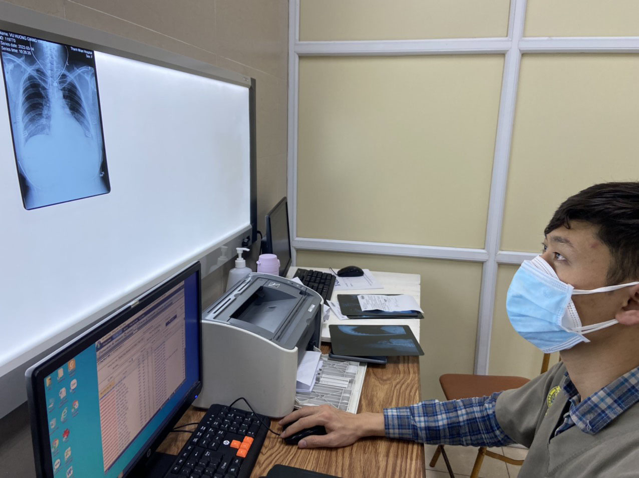 Phim chụp phổi của nngười bệnh hậu Covid-19.