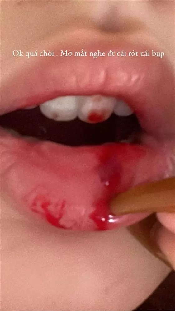 Đây chỉ là một tai nạn mà thôi.