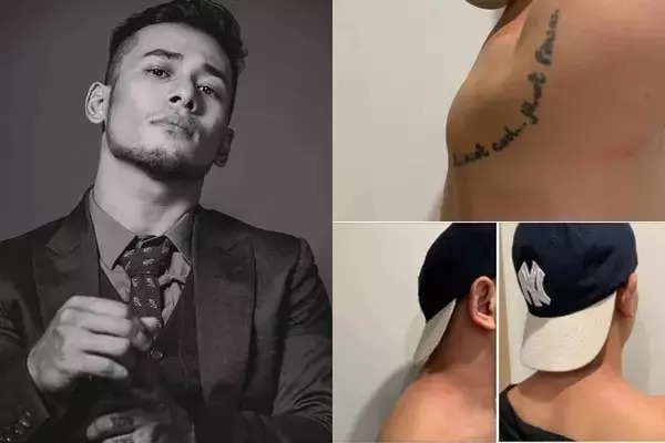 Tùng Min bị quản lý tố hành hung khi người này yêu cầu trả lại điện thoại.