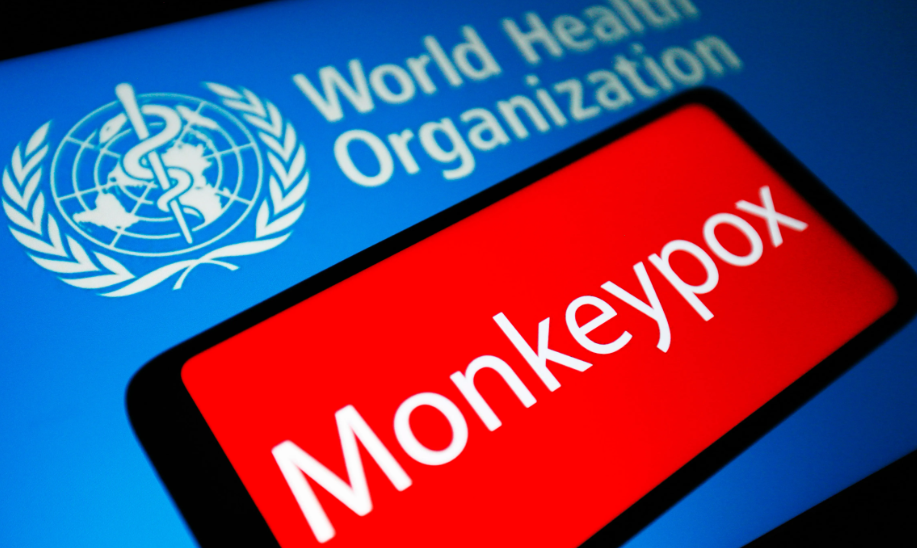 Bệnh đậu mùa khỉ lan đến Nhật Bản