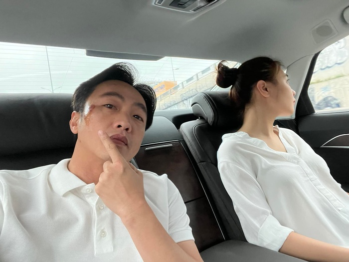 Cường Đô La và vết thương trên mặt