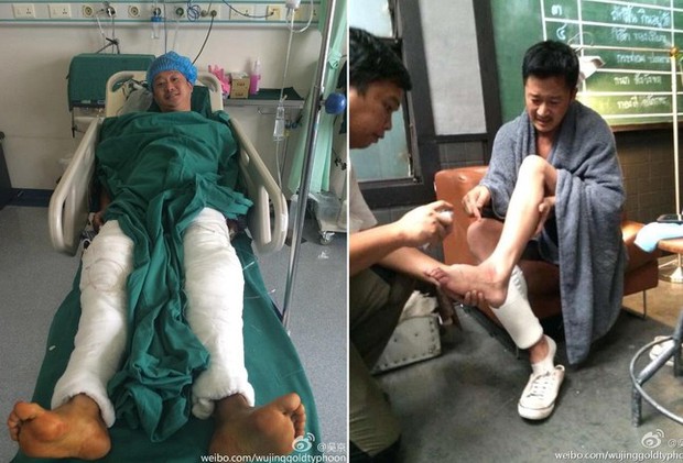 Ngô Kinh thường xuyên tái phát chấn thương, phải chống nạng để di chuyển. Ảnh: Sina