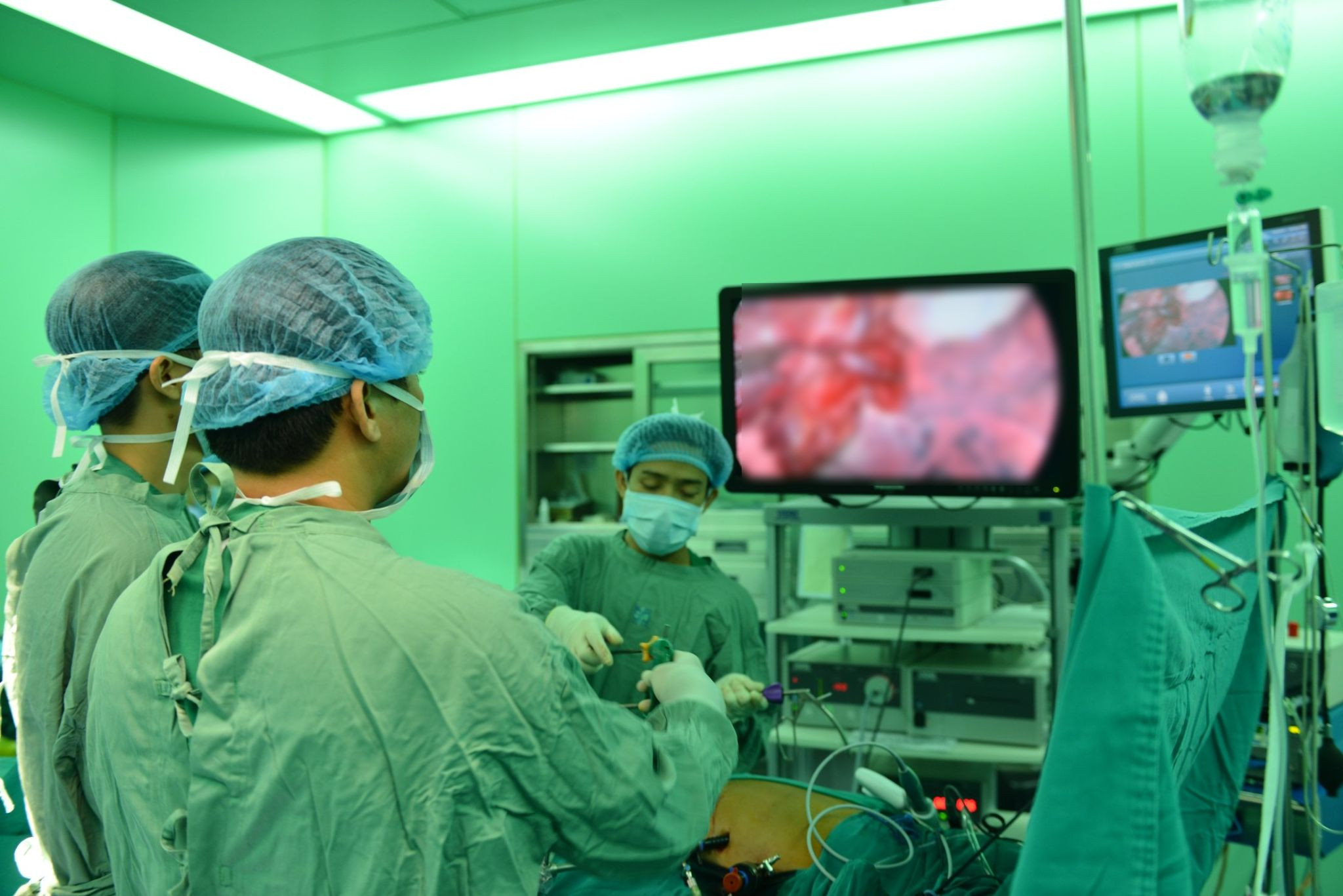 Phẫu thuật cho bệnh nhân ung thư dạ dày di căn. 