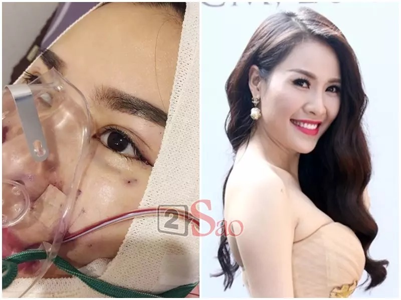 Quế Vân chi rất nhiều tiền để sang Hàn Quốc chỉnh sửa nhan sắc. Cô cho biết sửa mũi lại vì mũi cũ 