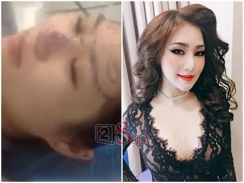 Hương Tràm từng bị lan truyền đoạn clip ở trong phòng mổ của một thẩm mỹ viện. Tuy nhiên, nhân vật chính trong clip lại không hề biết mình bị quay hình. 