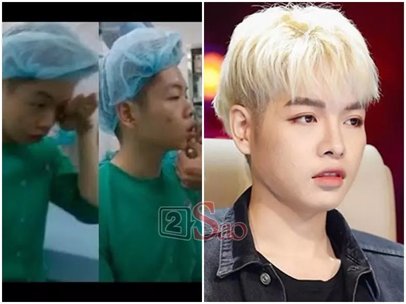 Đức Phúc là ca phẫu thuật thẩm mỹ gây nhiều xôn xao nhất của showbiz bởi sự lột xác trông thấy của một giọng ca có tài nhưng thiếu sắc. Những hình ảnh dao kéo của nam ca sĩ cũng được bệnh viện công khai toàn bộ.