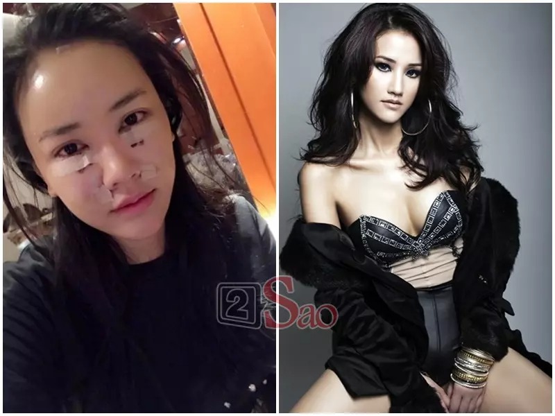 Vốn sở hữu khuôn mặt ưa nhìn nhưng vì muốn thay đổi cũng như nhu cầu đẹp hơn, Maya đã quyết định sang Hàn Quốc phẫu thuật thẩm mỹ. Thậm chí, Maya còn công khai cụ thể hình ảnh quá trình phẫu thuật. Với chi phí hơn 600 triệu đồng, Maya thực hiện xóa quầng thâm ở mắt, xóa rãnh nhăn...