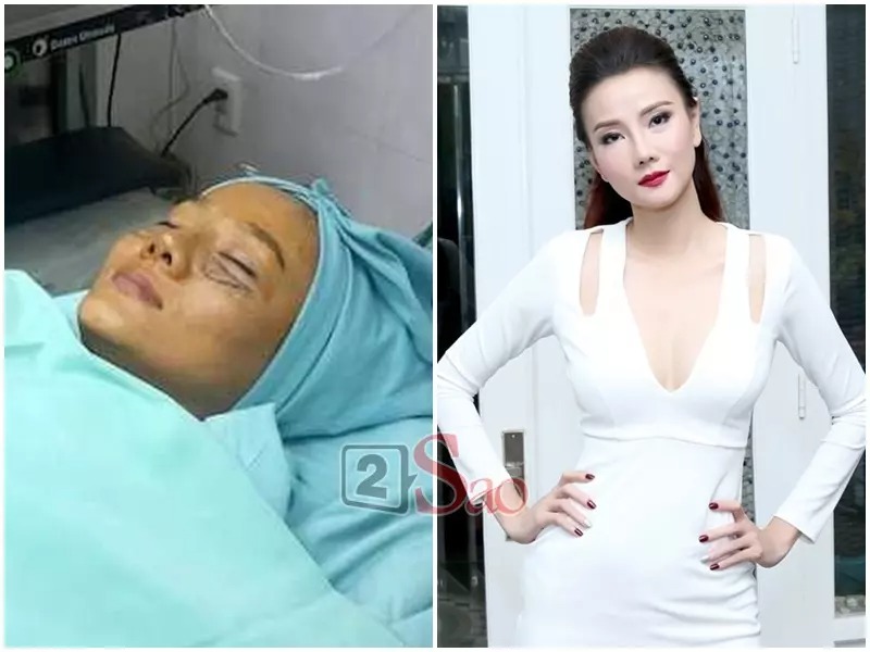 Sau sóng gió hôn nhân, Dương Yến Ngọc dần lấy lại tinh thần và quyết định quay trở lại công việc với diện mạo mới. Cựu người mẫu còn thực hiện một số tiểu phẫu trên khuôn mặt như mắt, mũi và gò má để có được nhan sắc hoàn hảo.