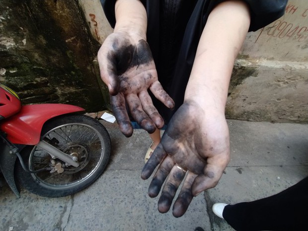 Bàn tay lấm lem của một nữ sinh khi vừa dọn dẹp sau vụ cháy