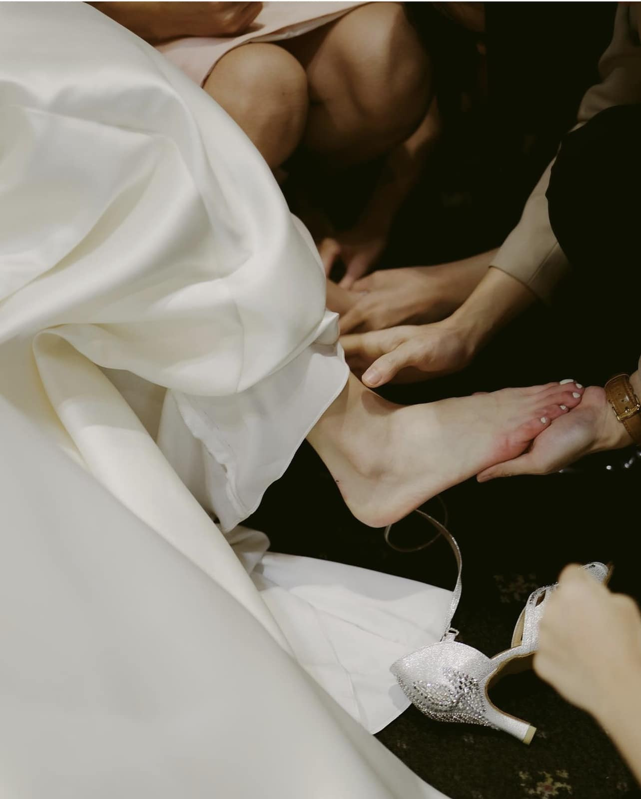 Sau hôn lễ, Thuỳ Dung bị bỏng ở hai bàn chân do khói lạnh.