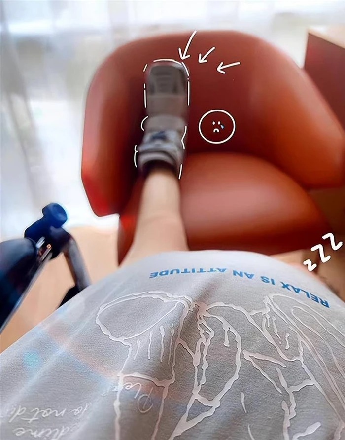 Thích Vy gặp chấn thương ở chân trong giai đoạn cuối thai kỳ.