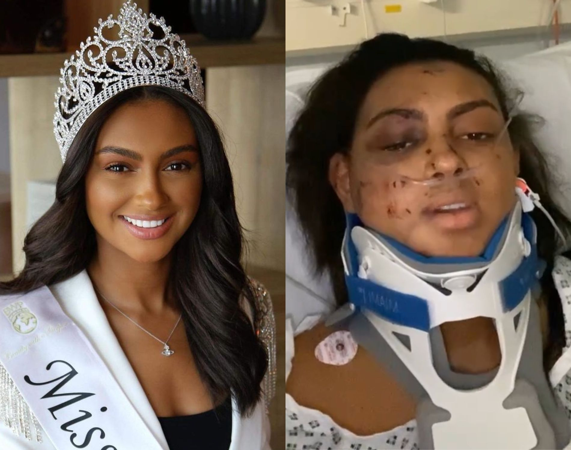 Darcey Corria gặp tai nạn giao thông nghiêm trọng