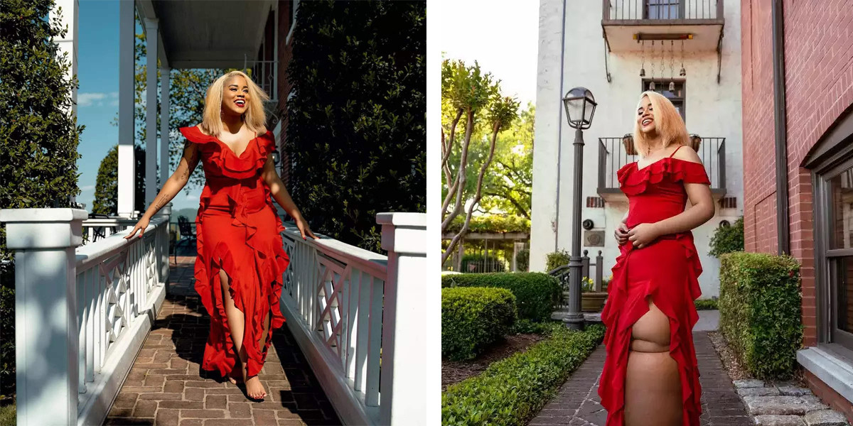 Vượt qua mặc cảm, Geter trở thành người mẫu ảnh. Ảnh: Today