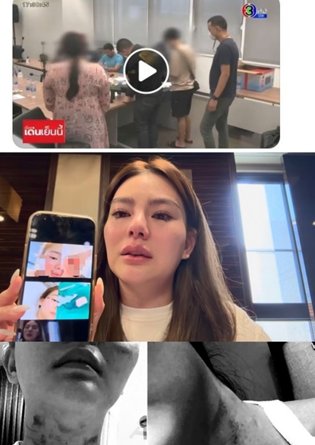 Due Arisara bị bạn trai cũ bạo hành suốt 2 năm.