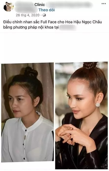 Tuy nhiên mới đây, cô nàng bị khui loạt ảnh từng quảng cáo cho dịch vụ điều chỉnh nhan sắc toàn mặt và body của một clinic.