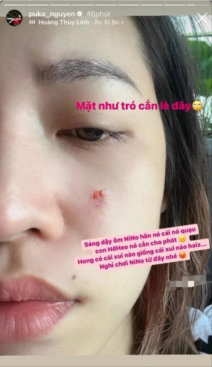 Puka khiến fan lo lắng vì bị thú cưng tấn công.