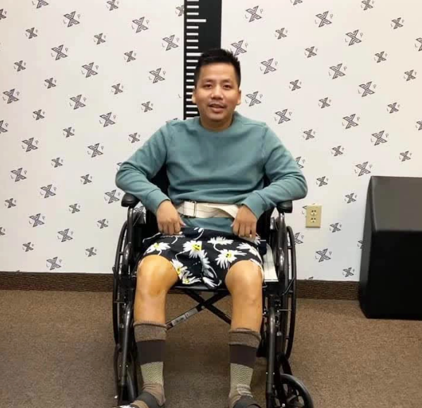 Vốn là YouTuber nổi tiếng với loạt video trải nghiệm những nơi sang chảnh, đắt đỏ nhất trên toàn thế giới, Khoa Pug càng thu hút hơn khi quyết định phẫu thuật kéo chân.