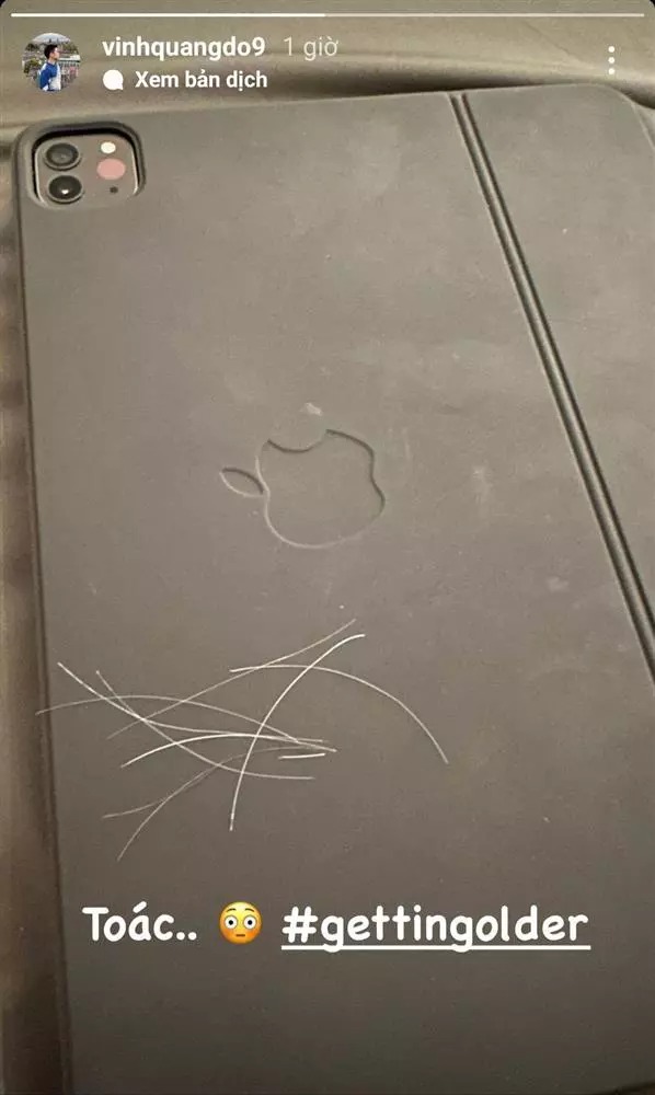 Đỗ Vinh Quang chia sẻ hình ảnh nhổ tóc bạc, tự nhận đang già đi.