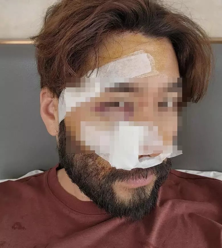 Gương mặt Noh Hong Chul sau tai nạn