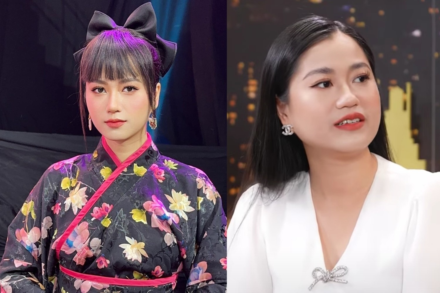 Sự khác biệt rõ nét trên hình dáng khuôn mặt - thon gọn, hài hòa hơn xưa khiến khán giả nghi vấn nữ diễn viên đã 