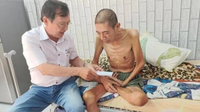 Trong những ngày tháng cuối đời, nhạc sĩ Lê Quốc Dũng được anh trai chăm sóc và sinh sống tại căn nhà bố mẹ để lại cho hai anh em