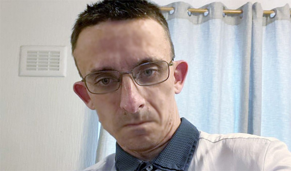 Khối u não đã kìm hãm sự phát triển của Jamie. Ảnh: Mirrror