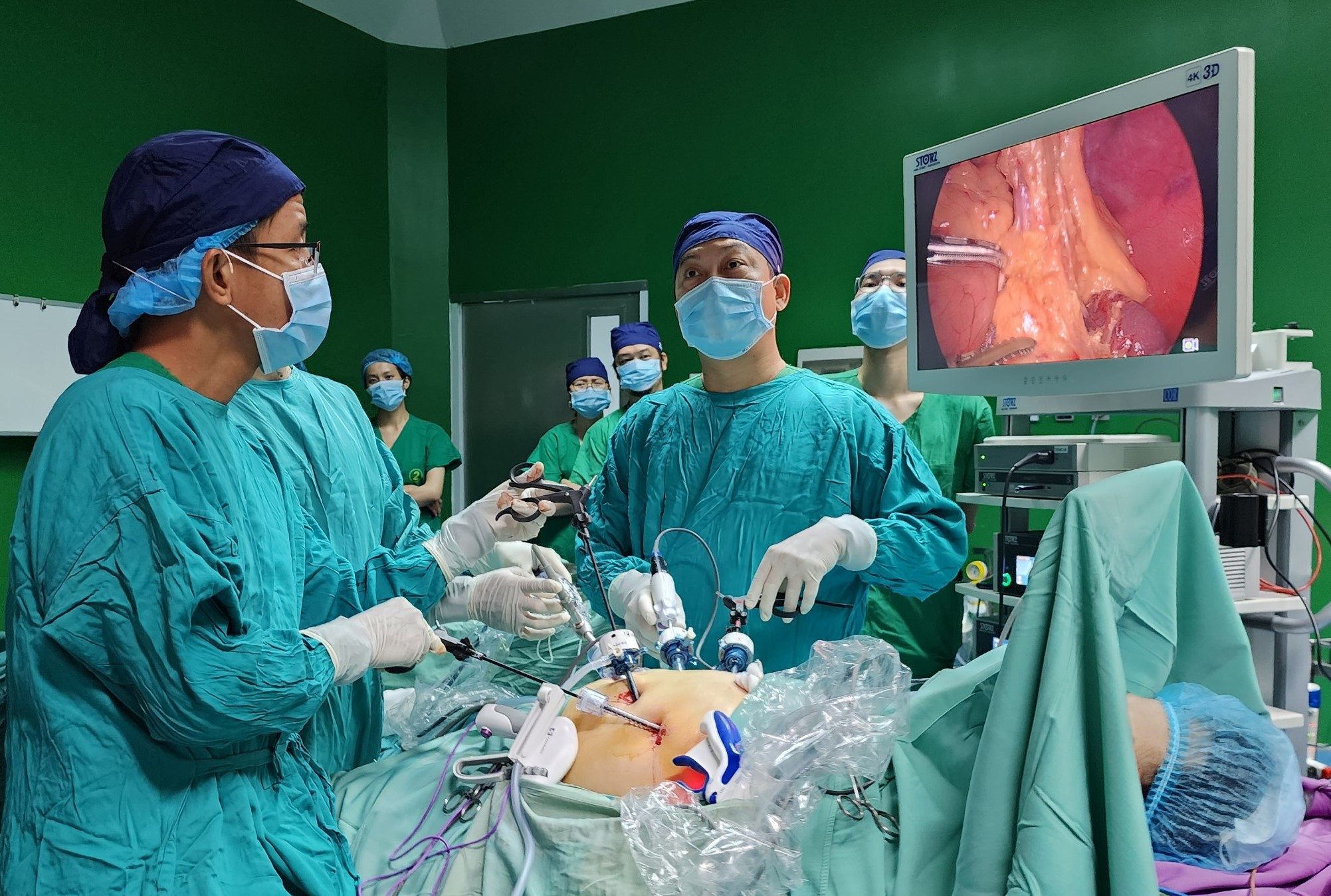 Bác sĩ Võ Duy Long phẫu thuật nội soi cắt nửa trên dạ dày cho người bệnh ung thư. Ảnh: BVCC.