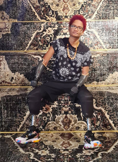 Hiện Tatiana đã lắp tay chân giả. Ảnh: The SunHiện Tatiana đã lắp tay chân giả. Ảnh: The Sun