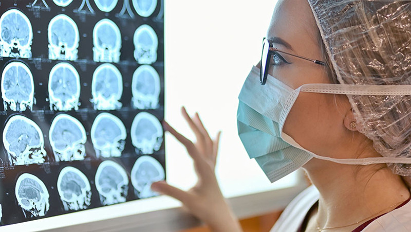 Ung thư não để lại nhiều hậu quả nghiêm trọng nhưng có thể khắc phục nếu phát hiện sớm. Ảnh: Uchicagomedicine