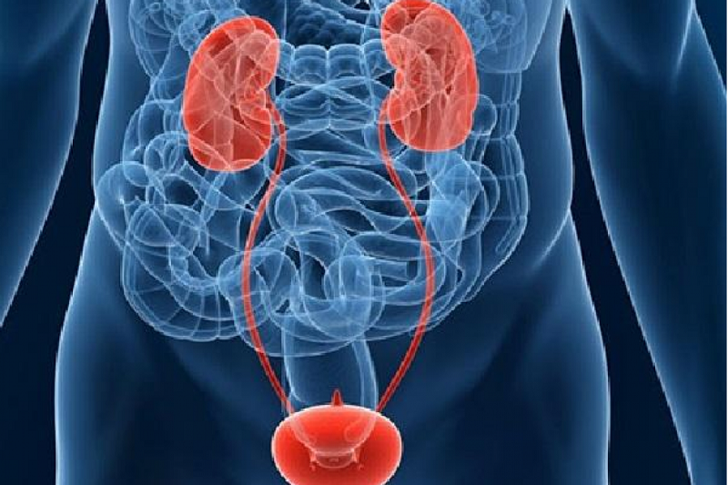 Ung thư bàng quang là bệnh phổ biến ở nam giới xuất phát từ dấu hiệu tiểu ra máu.