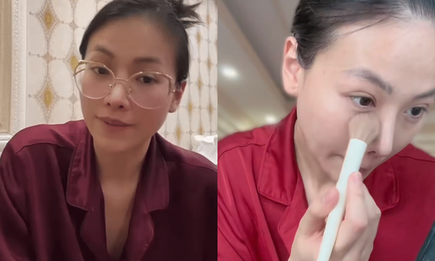 Hoa hậu Phương Khánh tiết lộ bản thân chỉ trang điểm nhẹ để tránh ảnh hưởng đến mắt và da mặt trong quá trình điều trị cường giáp