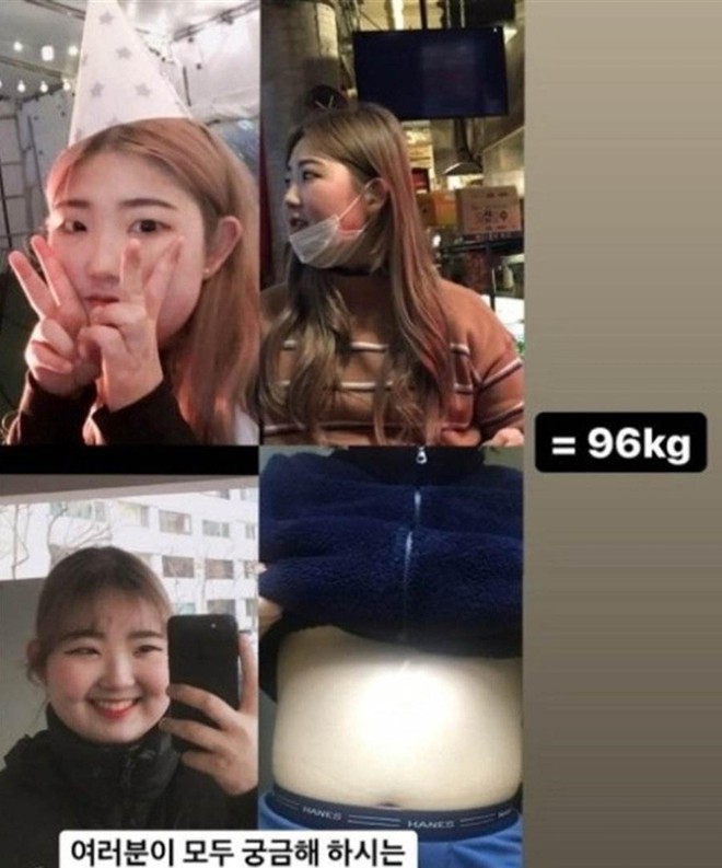 Choi Jun Hee chia sẻ cô từng có giai đoạn trầm cảm phải vào bệnh viện điều trị hơn một năm. Bên cạnh đó, việc mắc bệnh Lupus ban đỏ khiến cân nặng của Choi Jun Hee tăng không kiểm soát. Có thời điểm cô nặng tới 96 kg. Vì thân hình kém thon gọn, Choi Jun Hee càng thiếu tự tin, khiến bệnh trầm cảm nặng hơn. Vòng tuần hoàn đó dường như khiến thiếu nữ ở độ tuổi 17 gục ngã.