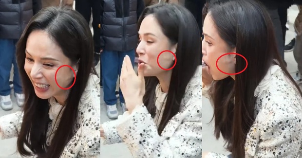 Tuy nhiên, vẻ đẹp không tuổi nổi tiếng của Lý Nhược Đồng bị nghi ngờ đã can thiệp 