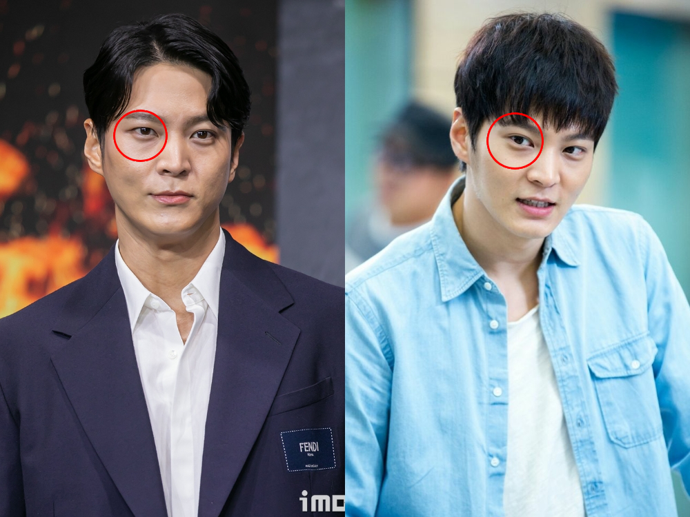 Mắt phải của Joo Won bỗng thay đổi hẳn so với trước kia (hình phải). Giờ đây, mắt phải mỹ nam 8X bỗng không còn nếp gấp mí