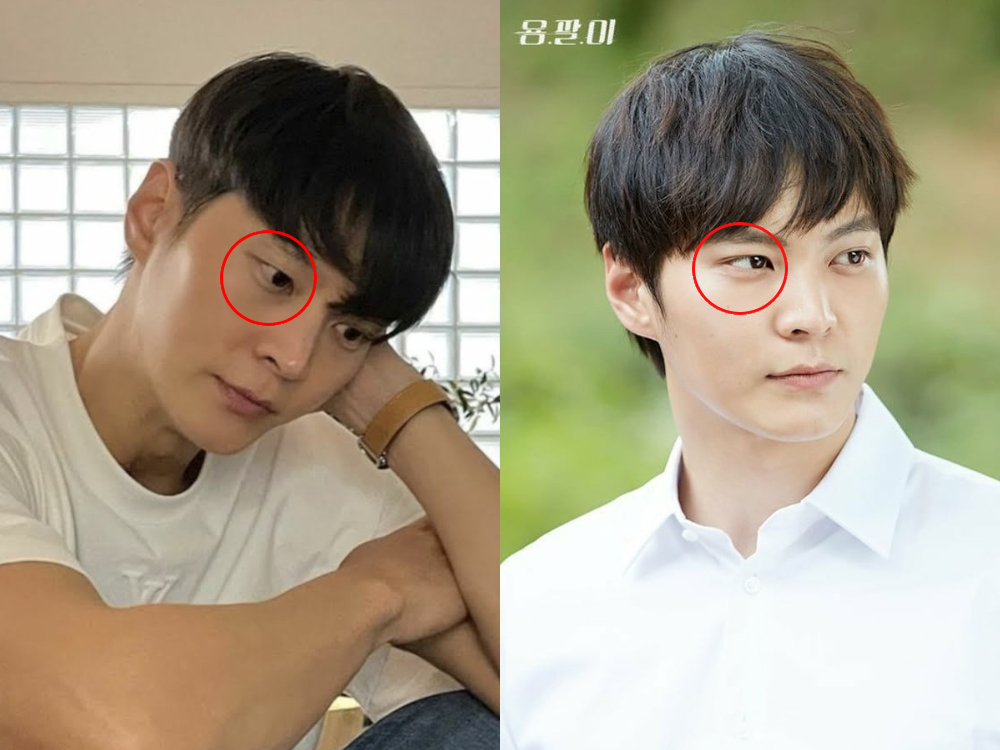 Truyền thông nhận định mắt tài tử trở về trạng thái ban đầu 1 cách tự nhiên, không phải do đụng chạm 