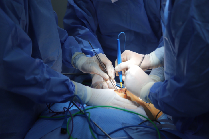 Các bác sĩ phẫu thuật cho bệnh nhân ung thư gan. Ảnh: BVCC.