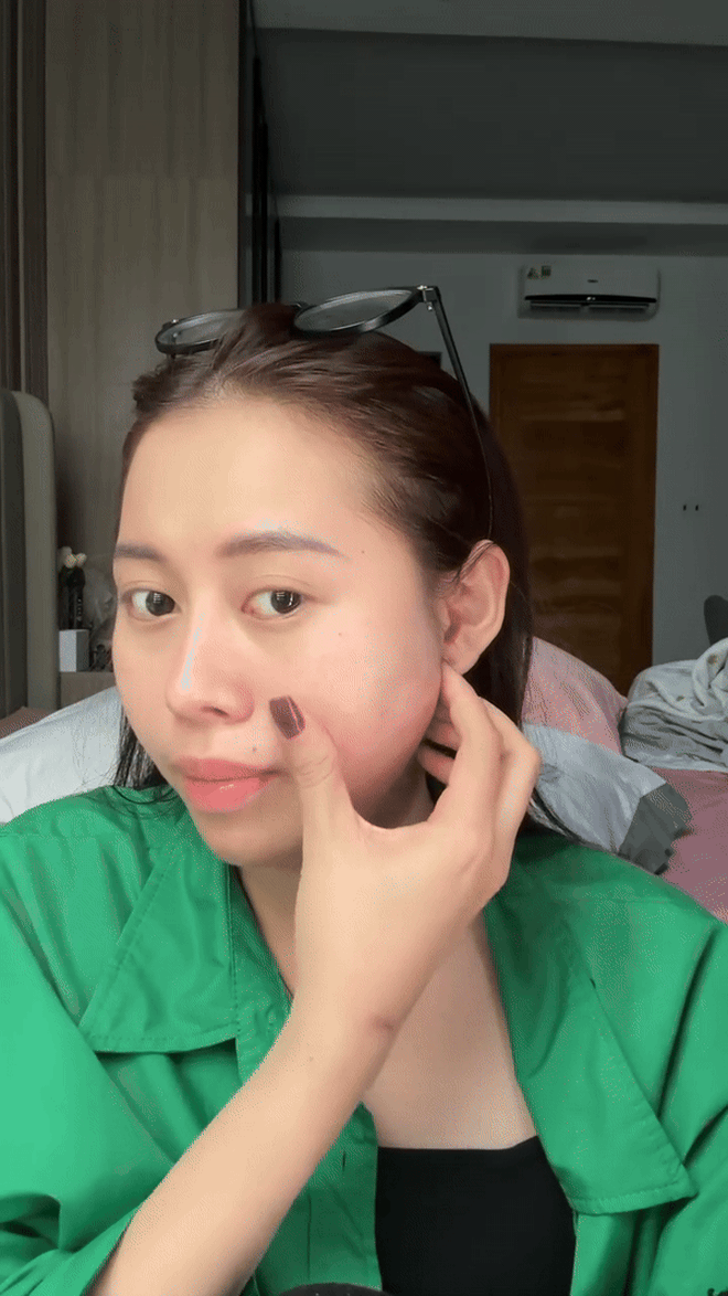 Tình trạng mặt trước khi mổ bị căng cứng và viêm nặng