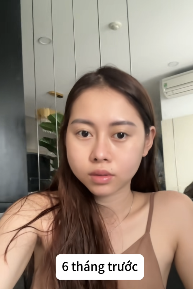 Mặt Việt Phương Thoa 6 tháng trước, bị sưng 2 bên má