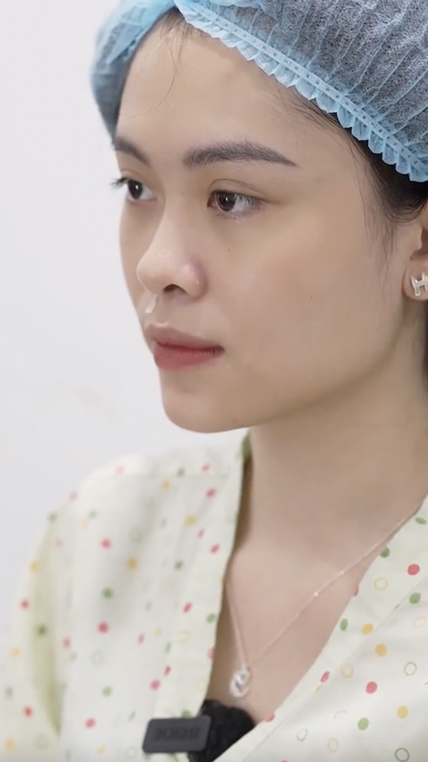 Ngân Hà cũng từng công khai chỉnh sửa nhan sắc như nâng mũi, tiêm filler,... nhờ vậy mà cô nàng có gương mặt cân đối hơn.