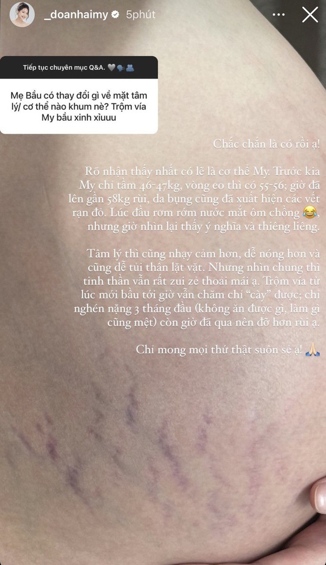 Doãn Hải My chia sẻ vết rạn trên bụng khi mang thai