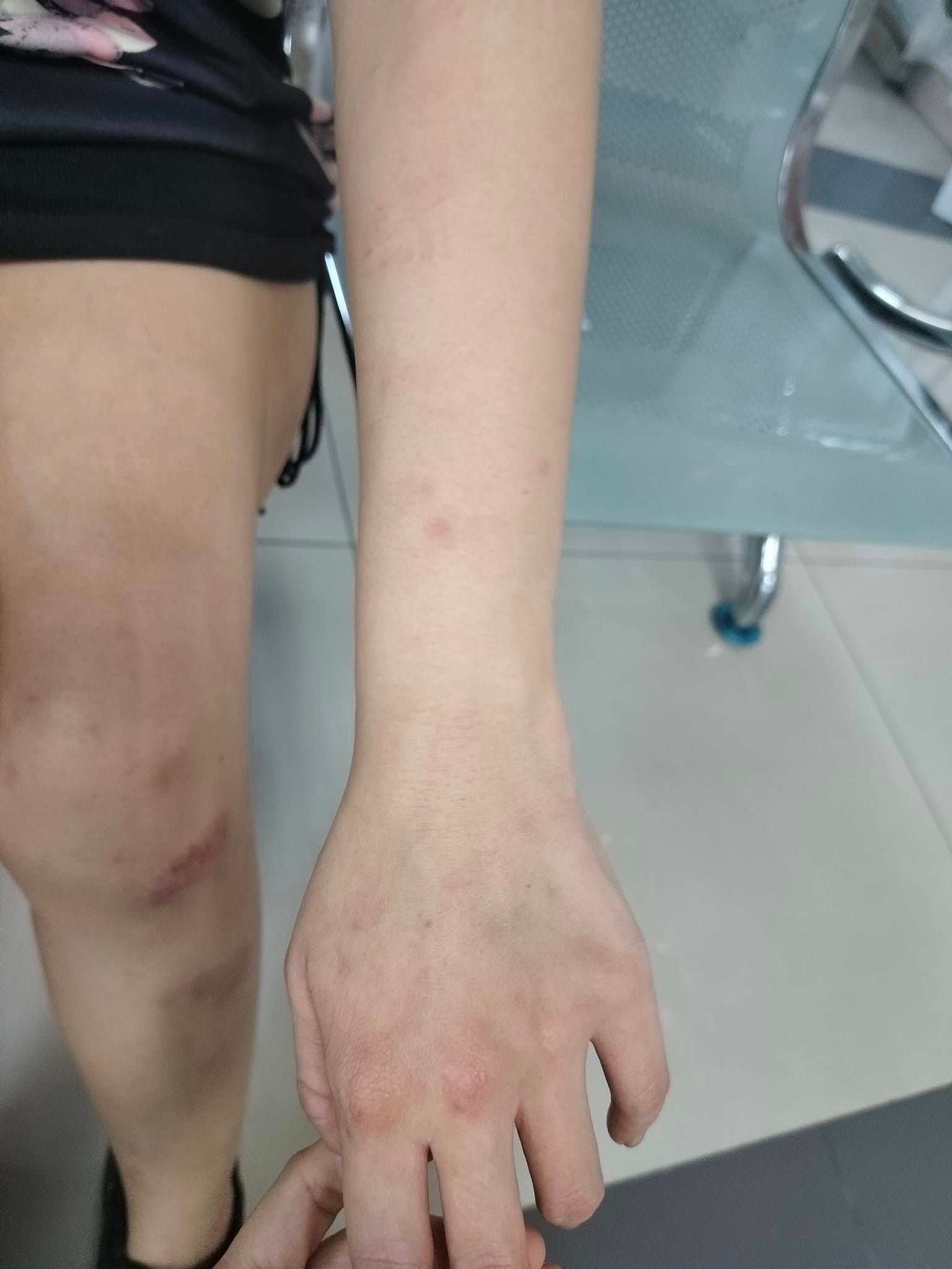 Người phụ nữ đã buộc phải cầu cứu sự giúp đỡ của bạn trai cũ.