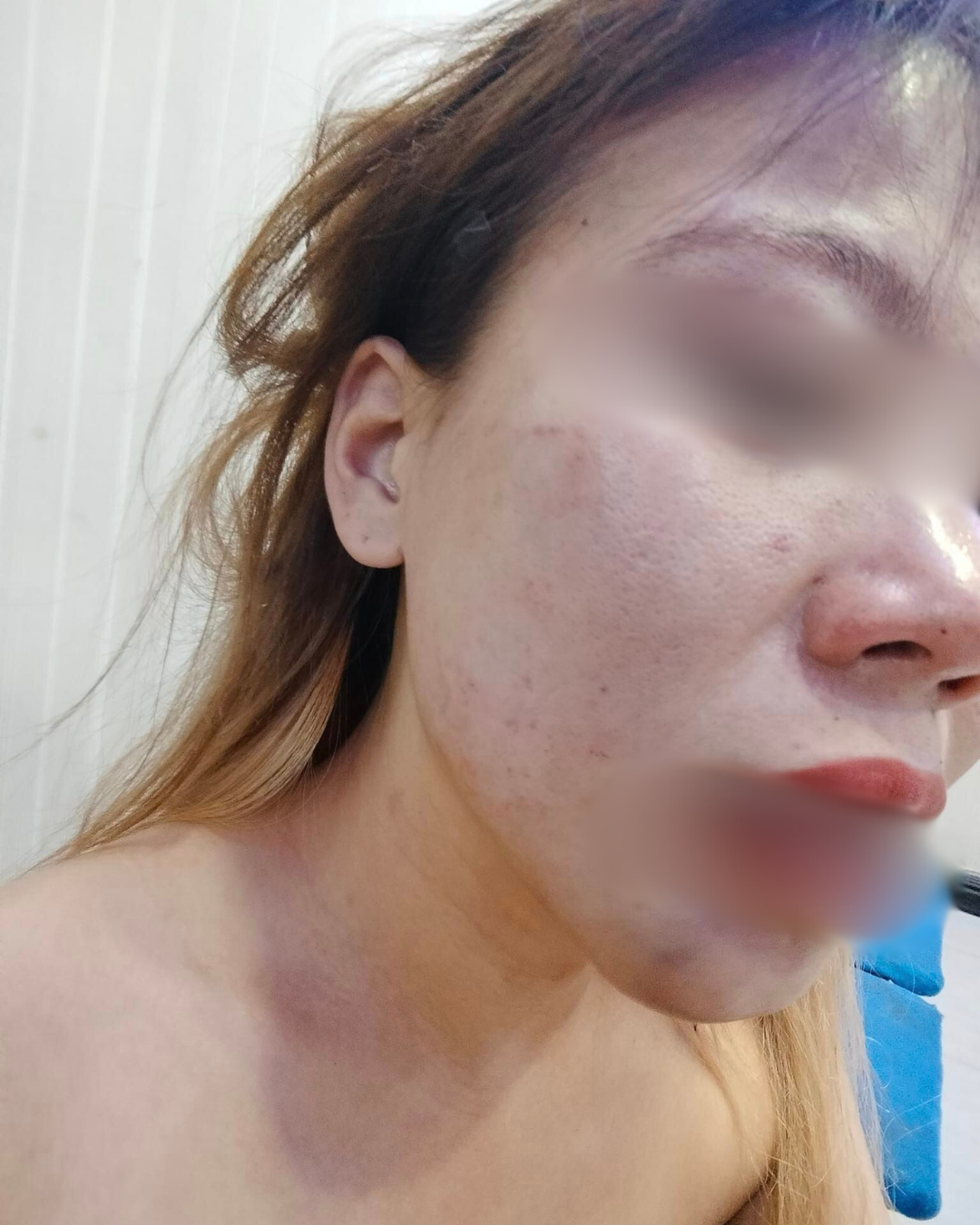 Người phụ nữ chia sẻ hình ảnh cơ thể có nhiều vết thương do bị chồng bạo hành.