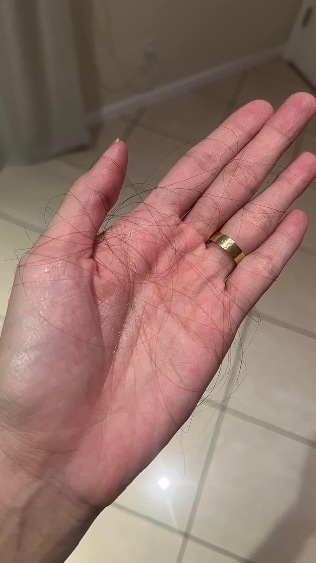 Võ Hoàng Yến từng đăng bài xin kinh nghiệm của các mẹ bầu khi bị rụng tóc quá nhiều