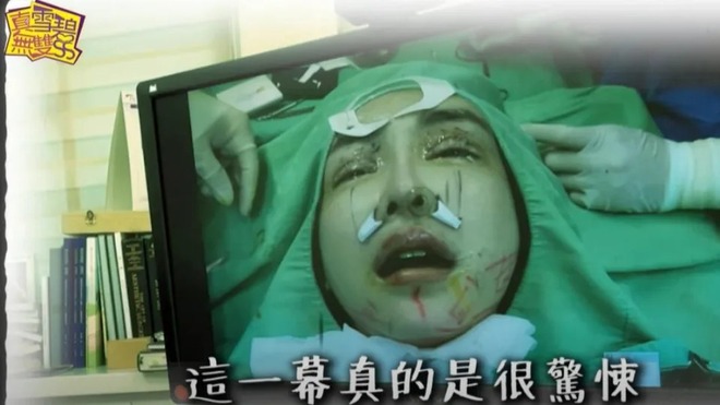 Cô từng gây xôn xao khi công khai hình ảnh nằm trên bàn phẫu thuật để thực hiện ca 