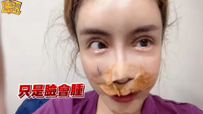 Phương Kỳ Viện nghiện phẫu thuật thẩm mỹ. Sao nữ sinh năm 1982 đã chi rất nhiều tiền để thực hiện hàng loạt ca 